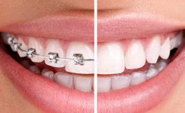 Orthodontics